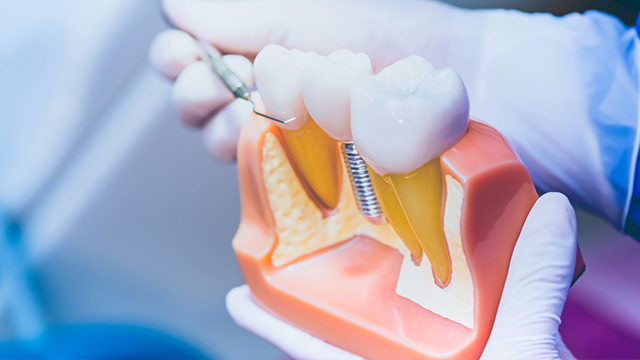 Riverdale Dental Arts | Veneers, Implant Dentistry and TMJ Disorders
